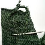 Chirurgie tricot (1)